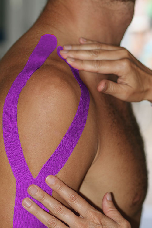 Taping – plastrowanie